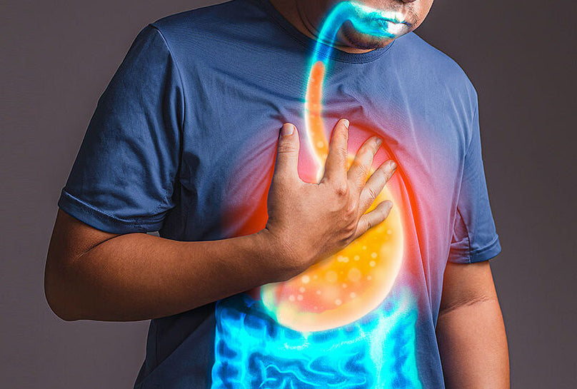 What is Gastroesophageal Reflux Disease (GERD)?